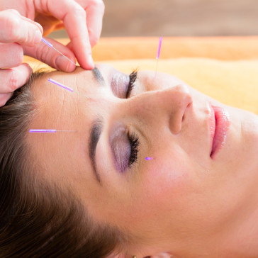Glenmore Park Physiotherapy - Acupuncture